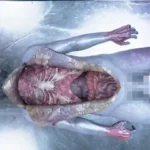 Autopsy Simulator